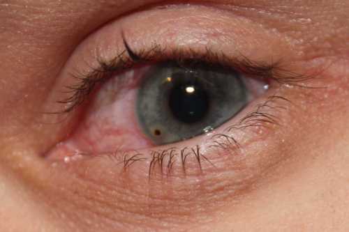 Почему болят глаза: как понять, что мешает чистому взгляду